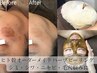 【シミ/シワ/ニキビ/毛穴◎】ハーブピーリング【剥離なし】天然×ヒト幹配合