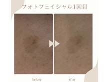 シャルム(Charme)