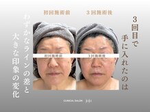 ジュジュ(juju)/３回目で初回とくらべると
