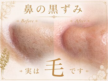グリッター 泉中央店(GLITTER)の写真/《フェイシャルWax脱毛》頑固な毛穴詰まりもスッキリ解消。触れたくなるようなツルスベ肌へ導きます!