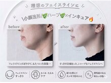ミロワール ドゥ サピュイェ(MIROIR de Sappuyer)