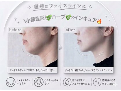 ミロワール ドゥ サピュイェ(MIROIR de Sappuyer)の写真