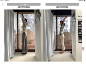 ナオル整体 大森店(NAORU整体)/30代女性、継続施術3ヶ月経過