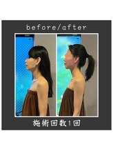 サロン ド ハーモニー美/コルギ♪ エラの改善・小顔