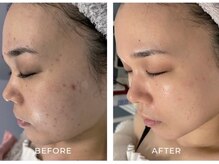 ルーメ(lume)/20代女性