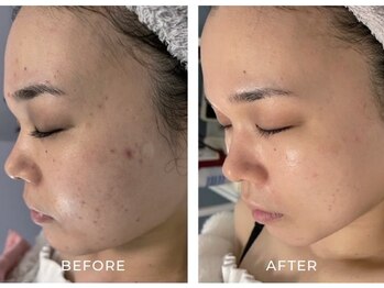 ルーメ(lume)/20代女性