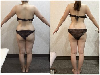 美容整体ウェリナ あま甚目寺院/小顔矯正/骨盤矯正/美脚サロン