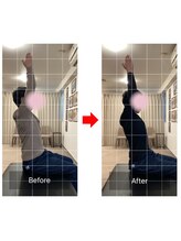 ナオル整体 十条院(NAORU整体)/before/after　【十条/背中痛】