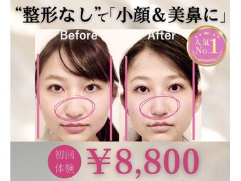 ラプリ 新宿店(Raplit)/隆鼻+輪郭矯正40分10回