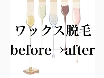 ジョアアンジェ 京橋店(joie ange)/ワックス脱毛