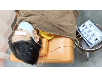 ノゾミ(Nozomi)/頭鍼（電気付き）