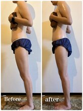 ランプリール 学芸大学(rempli)/【むくみ対策したいなら！】