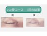 【オプション】目の悩み 眼精疲労eye愛コース　他のエステメニューと一緒に