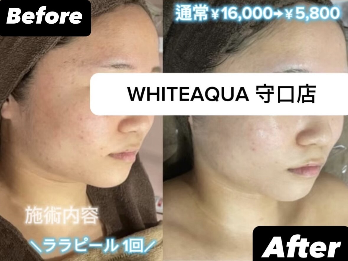ホワイトアクア 大分店(WHITE AQUA)｜ホットペッパービューティー