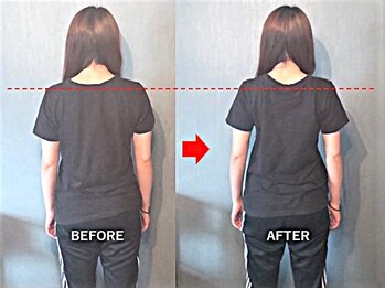 アトラス/初回のお客様のBefore＆after