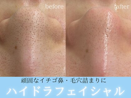 グランビューティ(Glanz Beauty)の写真
