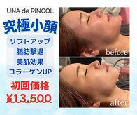 ウナ デ リンゴル 恵比寿店(UNA de Ringol)