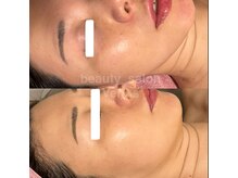 ヴィーナス(Venus)/韓国肌管理ララ/セラピール