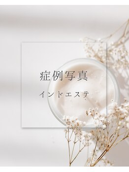 ポノーラ(Ponola)/