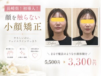 サンテ鍼灸院 整骨院の写真/触らない施術が評判！リピート率９割の小顔矯正で驚きビフォーアフターを初回3300円で体験しよう☆