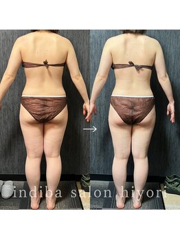 ヒヨリ(hiyori)/《before/after》body