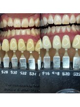 トウキョウスワーズ 池袋店(TOKYO SWRS)/#ホワイトニング #池袋 #渋谷