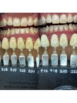 トウキョウスワーズ 池袋店(TOKYO SWRS)/#ホワイトニング #池袋 #渋谷