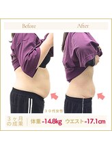 アロハ(ALOHA.)/1人目の妊娠前よりも痩せれた