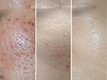 アート ビューティールーム(art beauty room)/☆オーダーメイド