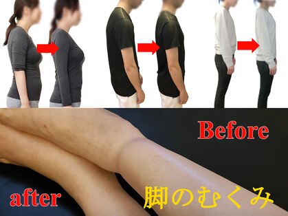 ベスト整体の写真