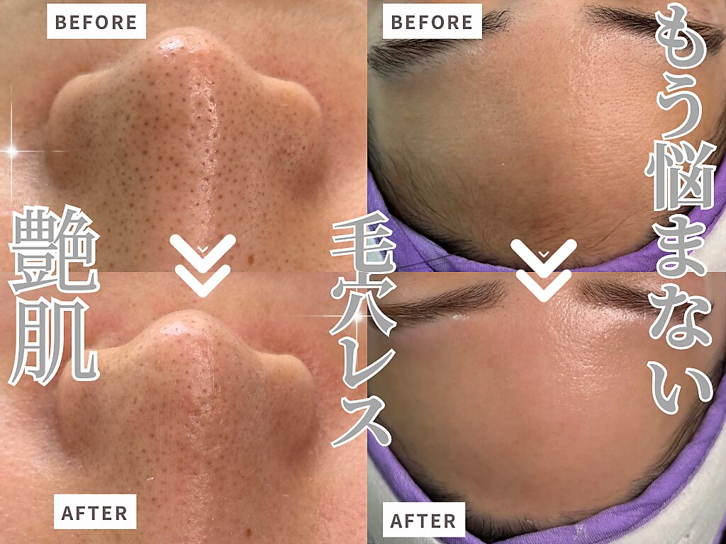 トリートメント Leon nZ2NcGtYi6NcuncQWaPa8UK-