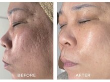 ルーメ(lume)/50代女性