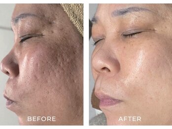 ルーメ(lume)/50代女性