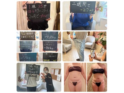 インタークロス(intercross)の写真