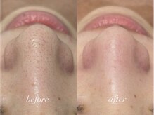 ポアレスラボ ジェンダーレスサロン 横浜/お客様ビフォーアフター