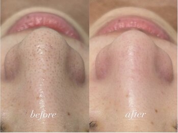 ポアレスラボ ジェンダーレスサロン 横浜/お客様ビフォーアフター