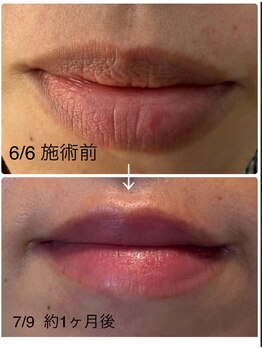 リュミエール デスポワール(Lumiere d'espoir)/ROMAPINK ローマピンク