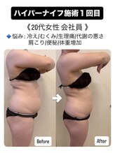 プアマヌ(PUA MANU)/ハイパーナイフ/痩身/肩こり解消