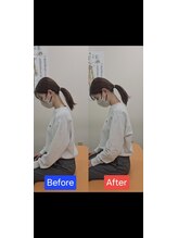 最後の整体 練馬駅前院/肩こりでお悩みの方の可動域