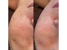 ビジュープラス ひたち野うしく店(Bijou+)/