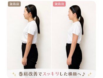 リフェイス(RE:FACE)の写真/《姿勢が変わると印象が変わる》　お顔とお身体同時ケア！