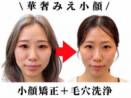 ブプラ 平岸店(BUPURA)の写真