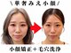 ブプラ 平岸店(BUPURA)の写真