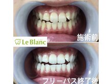 ルブラン 奈良店(Le Blanc)/歯は一生もの！