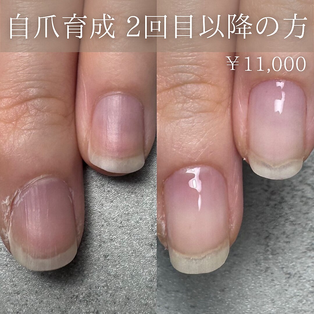 【自爪育成】2回目以降のご予約の方