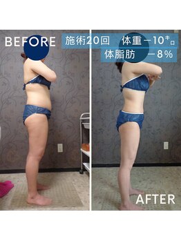 ヴィオテラス(VIOTERACE)/６ヶ月集中ダイエット☆