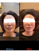 トーラス 整体(TORUS)/むくみ