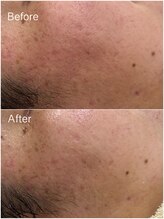 ジョアアンジェ 京橋店(joie ange)/赤み、乾燥ケア