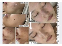 エメ(Aimer)の雰囲気（シミケア/ニキビケア/艶肌/くすみ解消/肌質改善エステ）