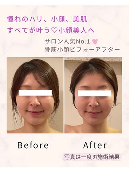 ティアラ(Tiara)/